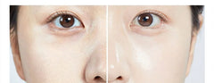 Crema de melanina MEDI-PEEL 73%