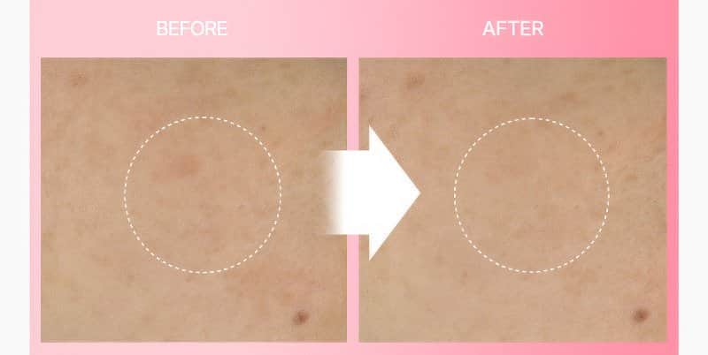 AprilSkin Pink Aloe Mucin Serum 50ml