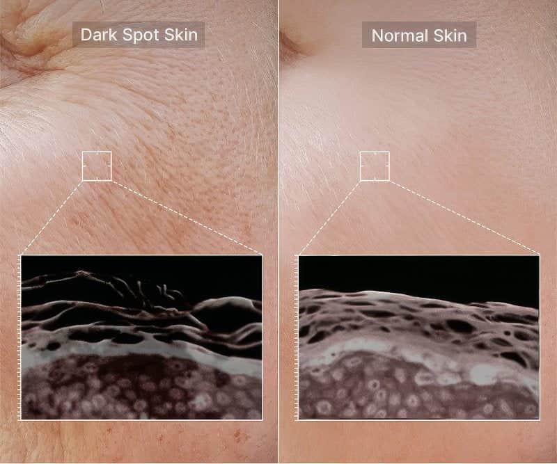 Medicube PDRN Pink Peptide Serum 50ml